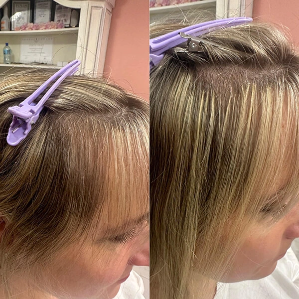 vlight hair extensions before and after